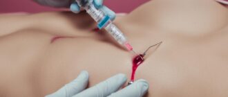 hormone injection for breast enlargement